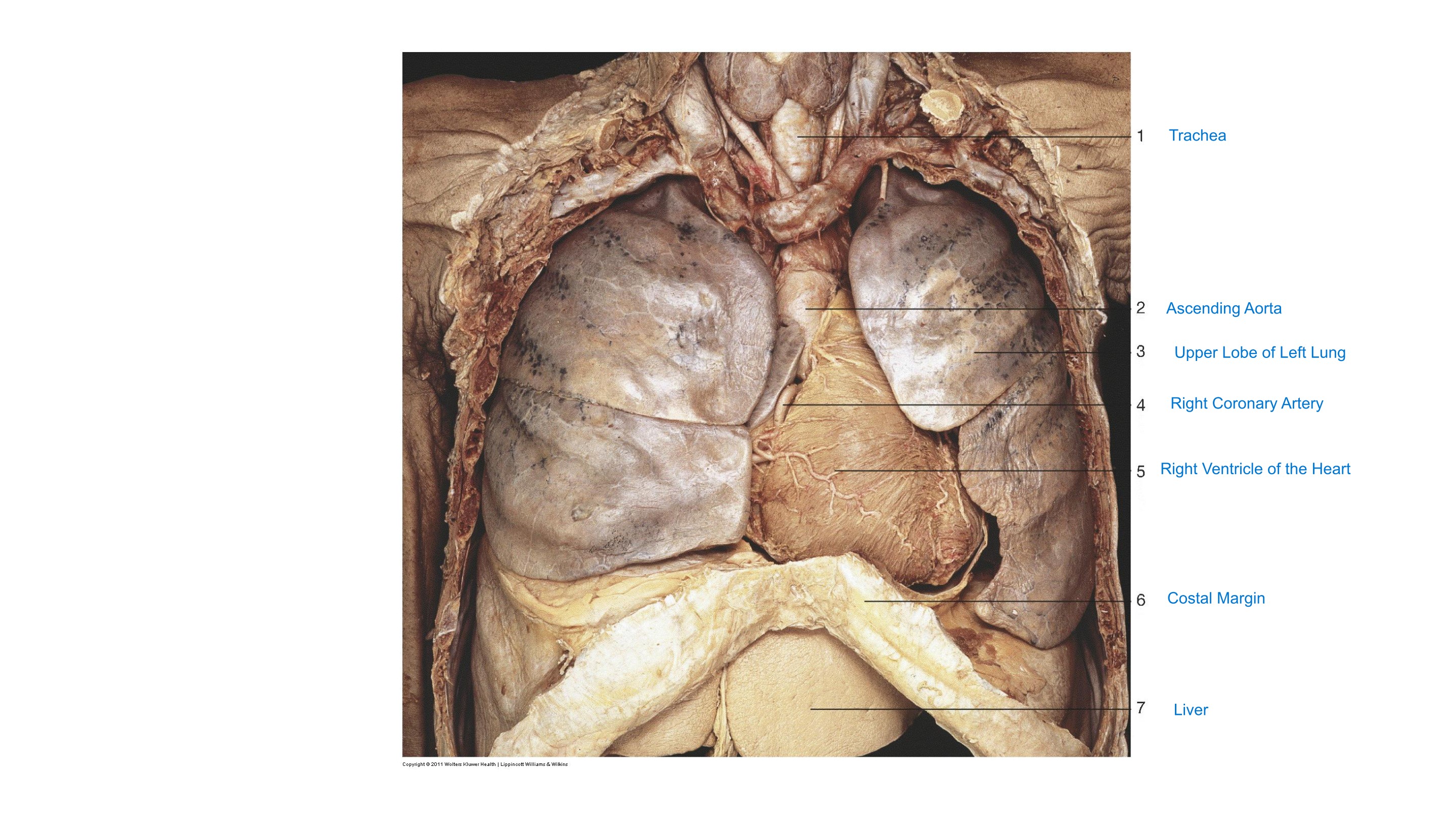 Thoracic Cavity (Anterior Aspect), fully labeled