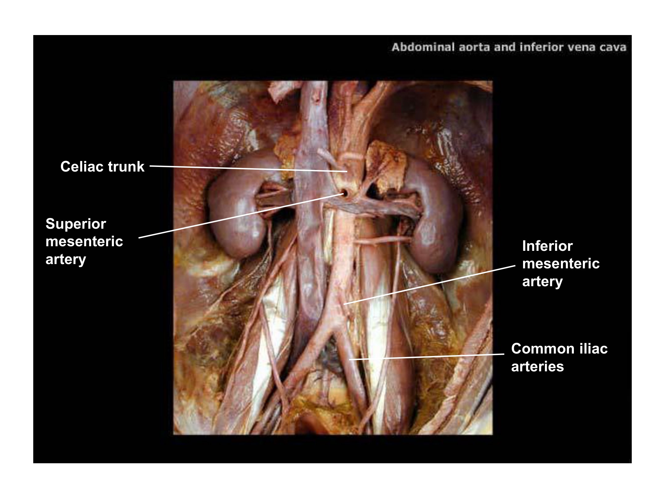 Abdominal Aorta and Inferior Vena Cava, fully labeled