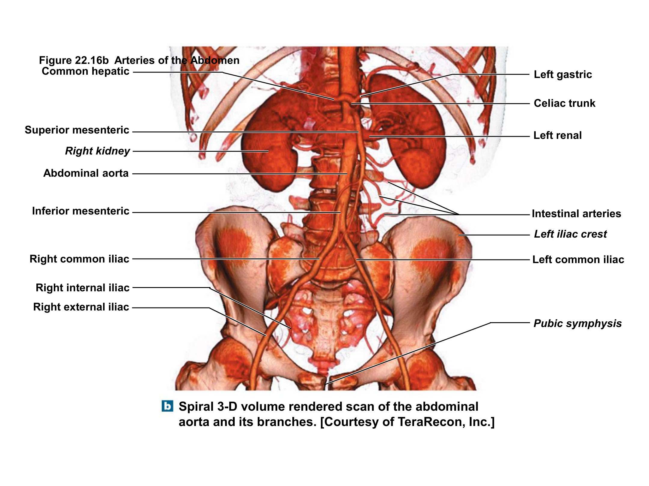 Abdominal Aorta and Inferior Vena Cava Branches, fully labeled