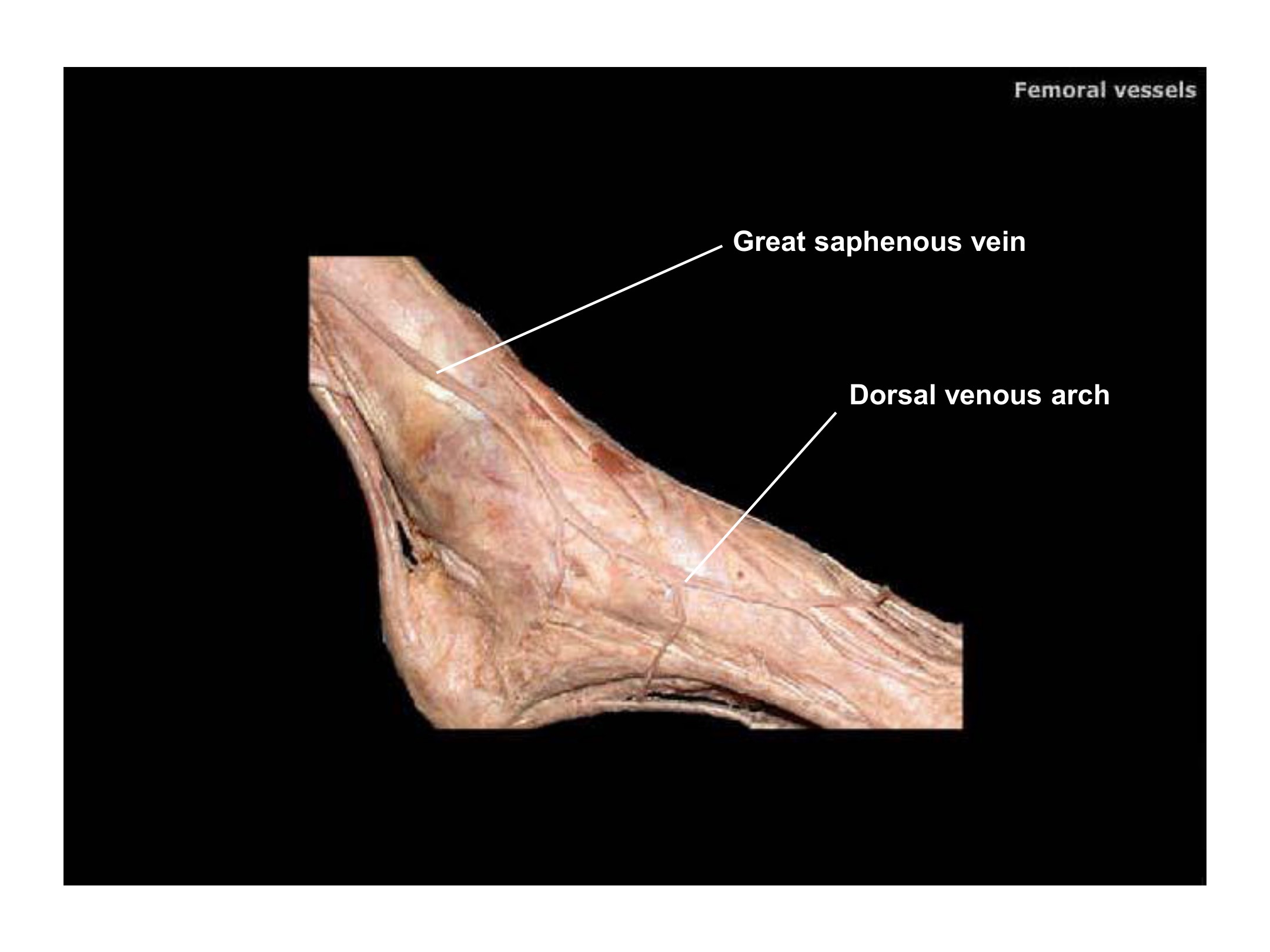 Great Saphenous Vein and Dorsal Venous Arch (Ankle/Foot), fully labeled