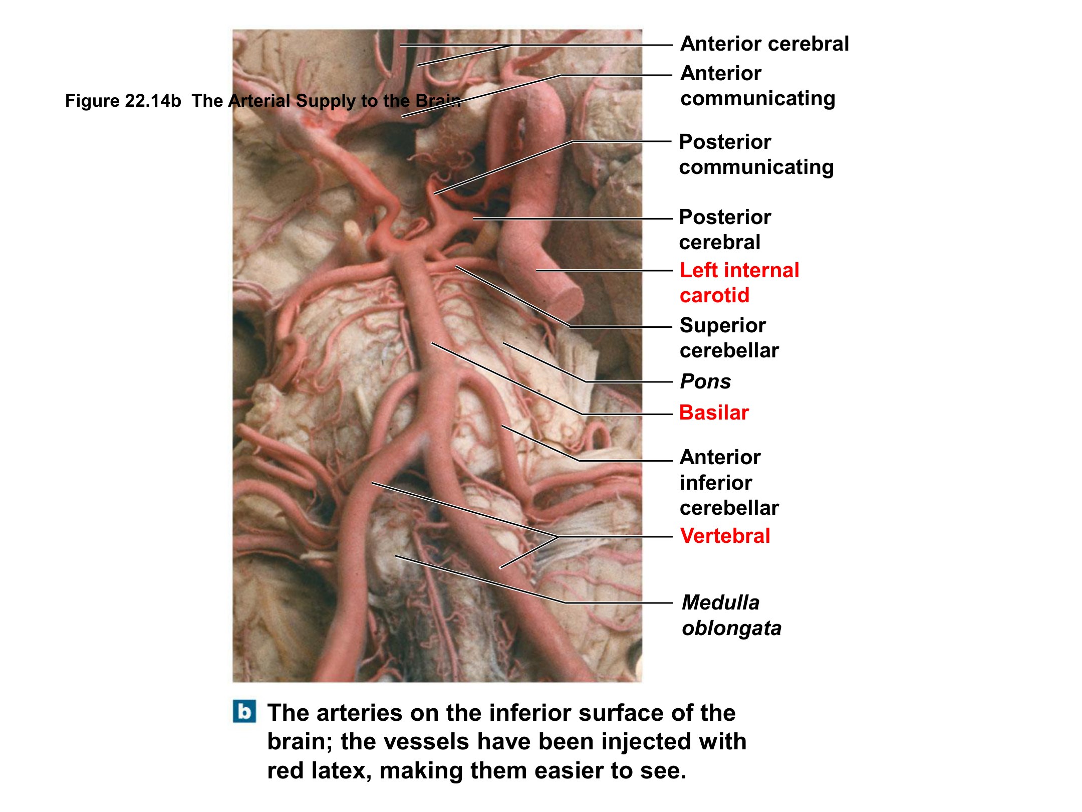 The Arterial Supply to the Brain (Detail), fully labeled