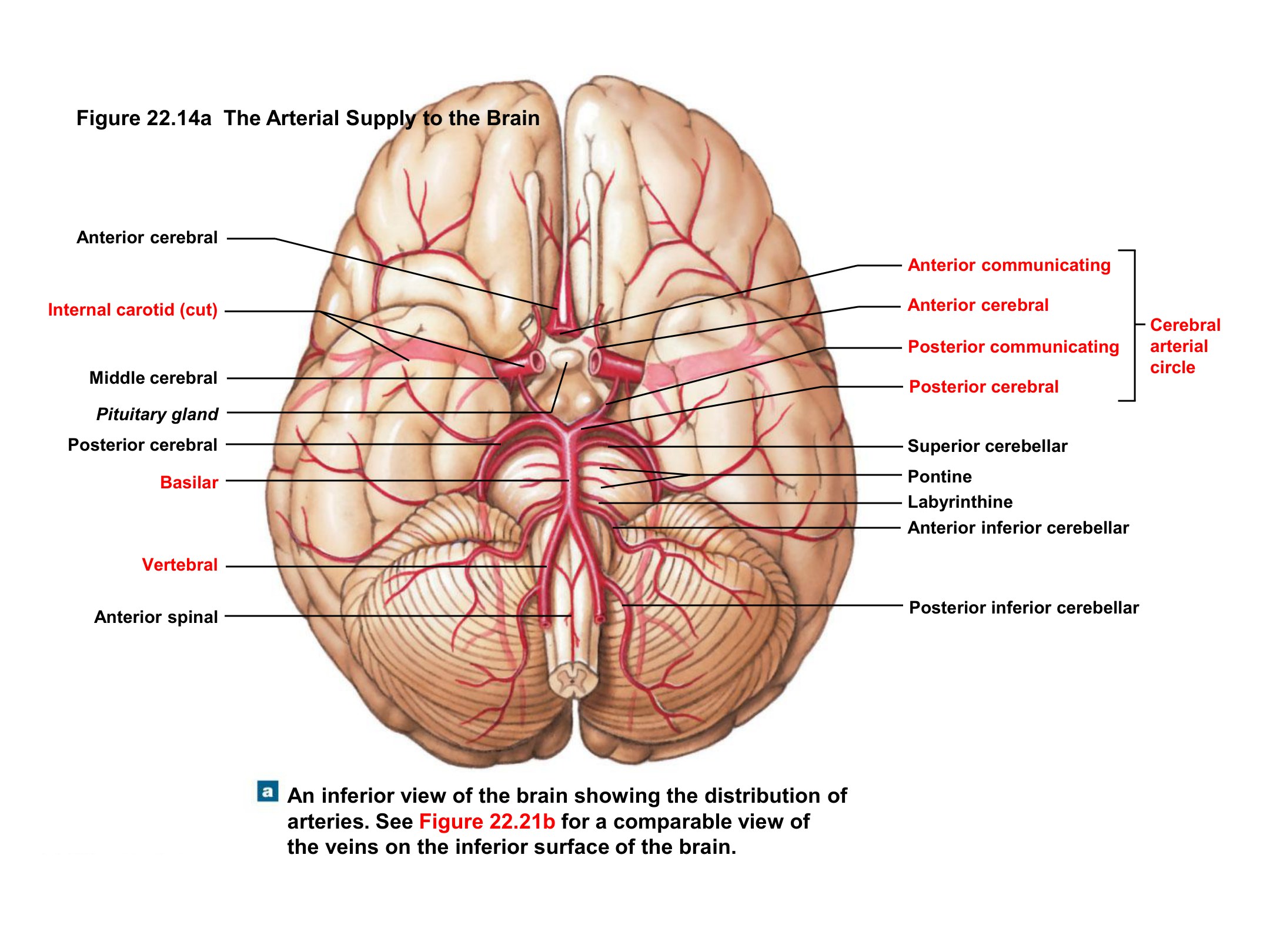 The Arterial Supply to the Brain (Inferior View), fully labeled