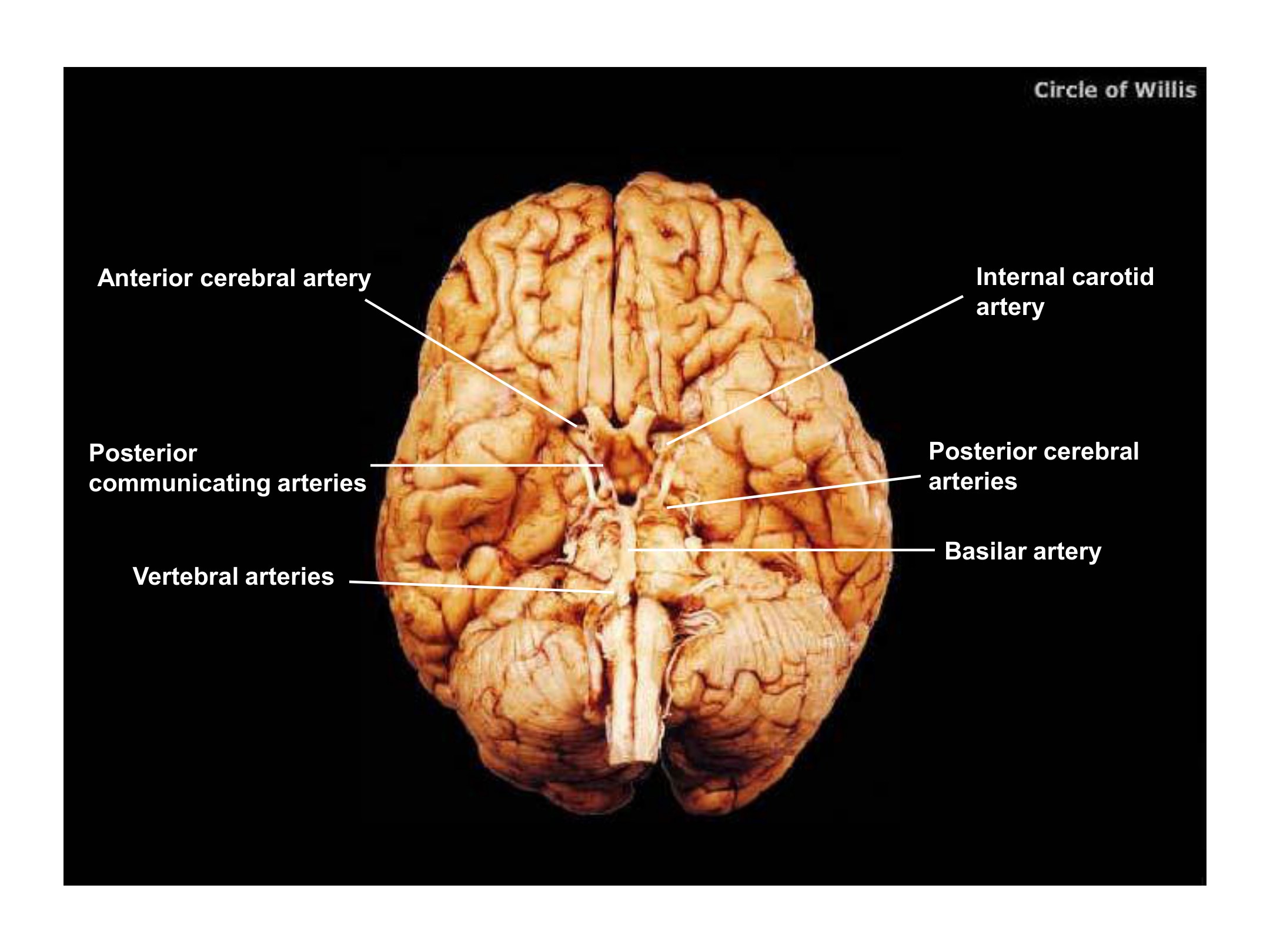 Circle of Willis, fully labeled