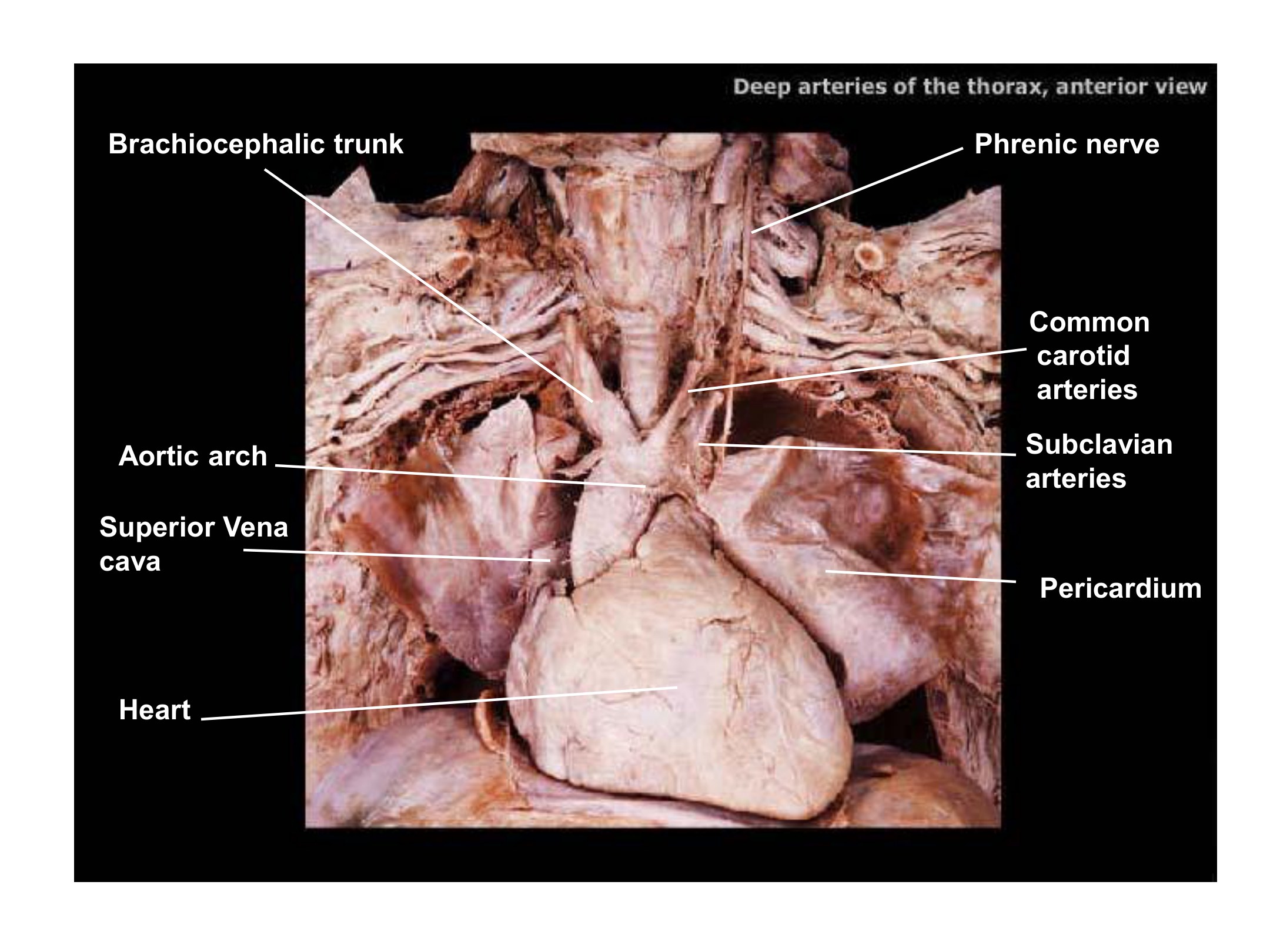 Deep Arteries of the Thorax, fully labeled