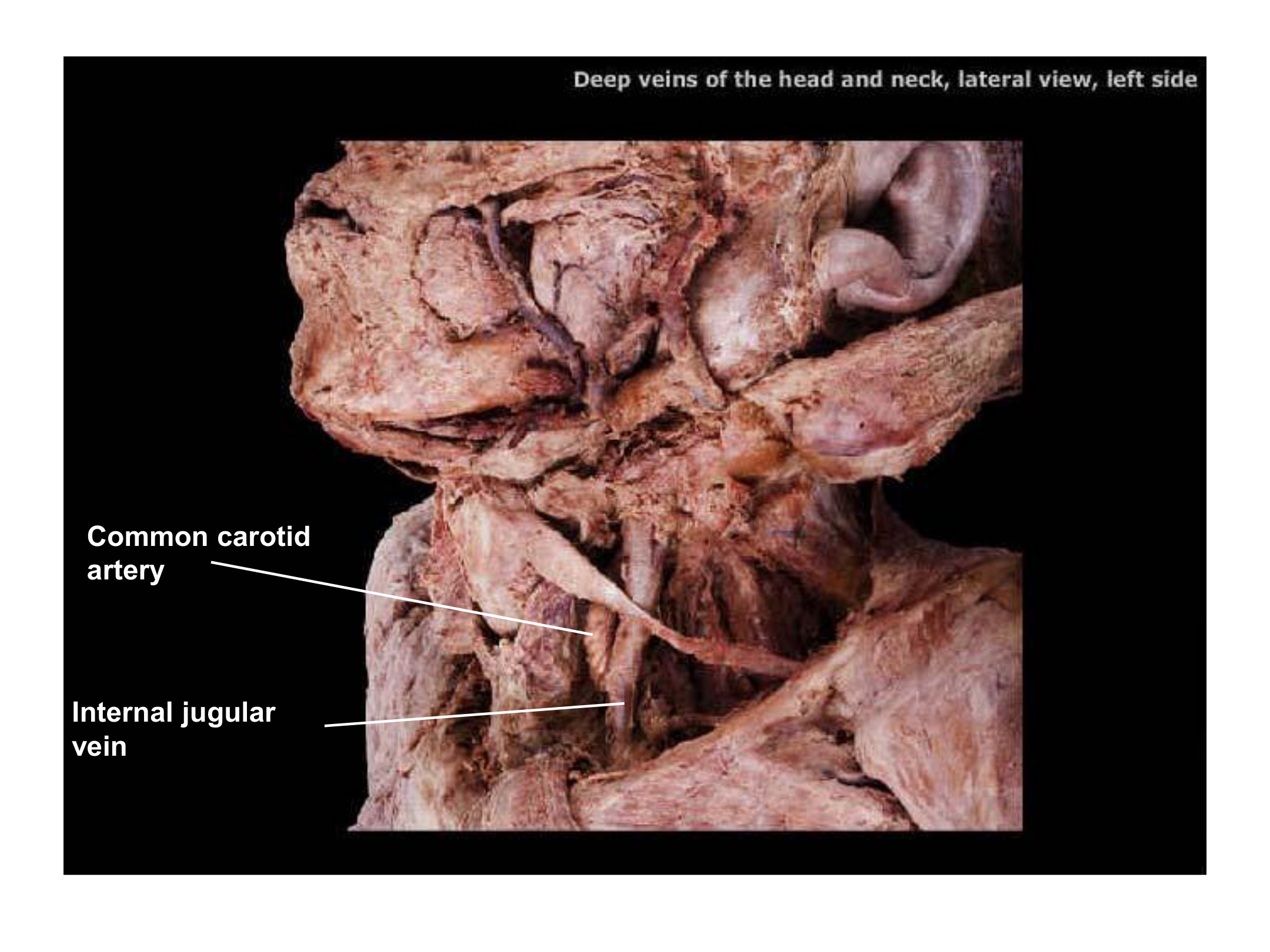 Deep Veins of the Head and Neck, fully labeled
