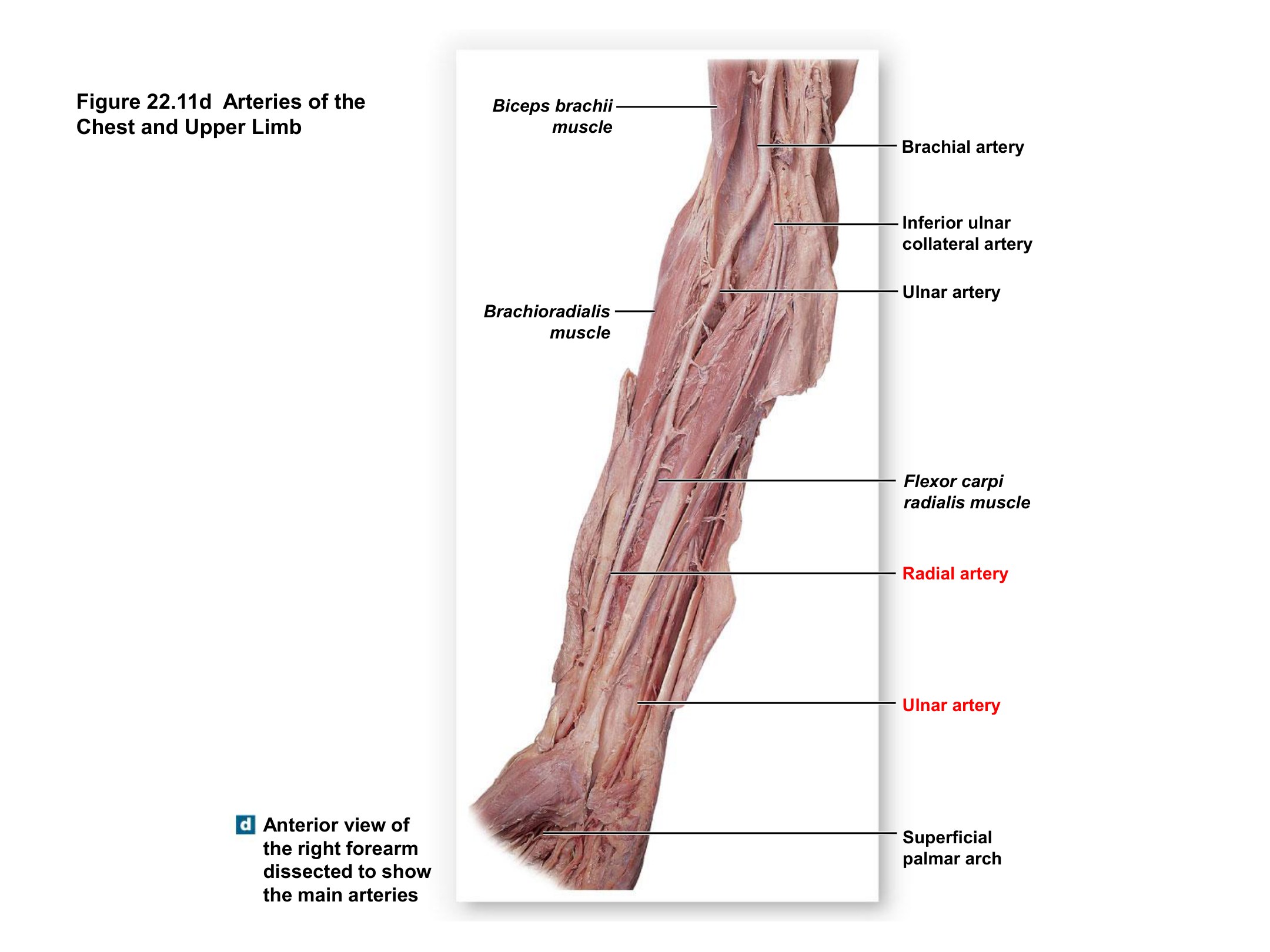 Arteries of the Right Forearm (Anterior View), fully labeled