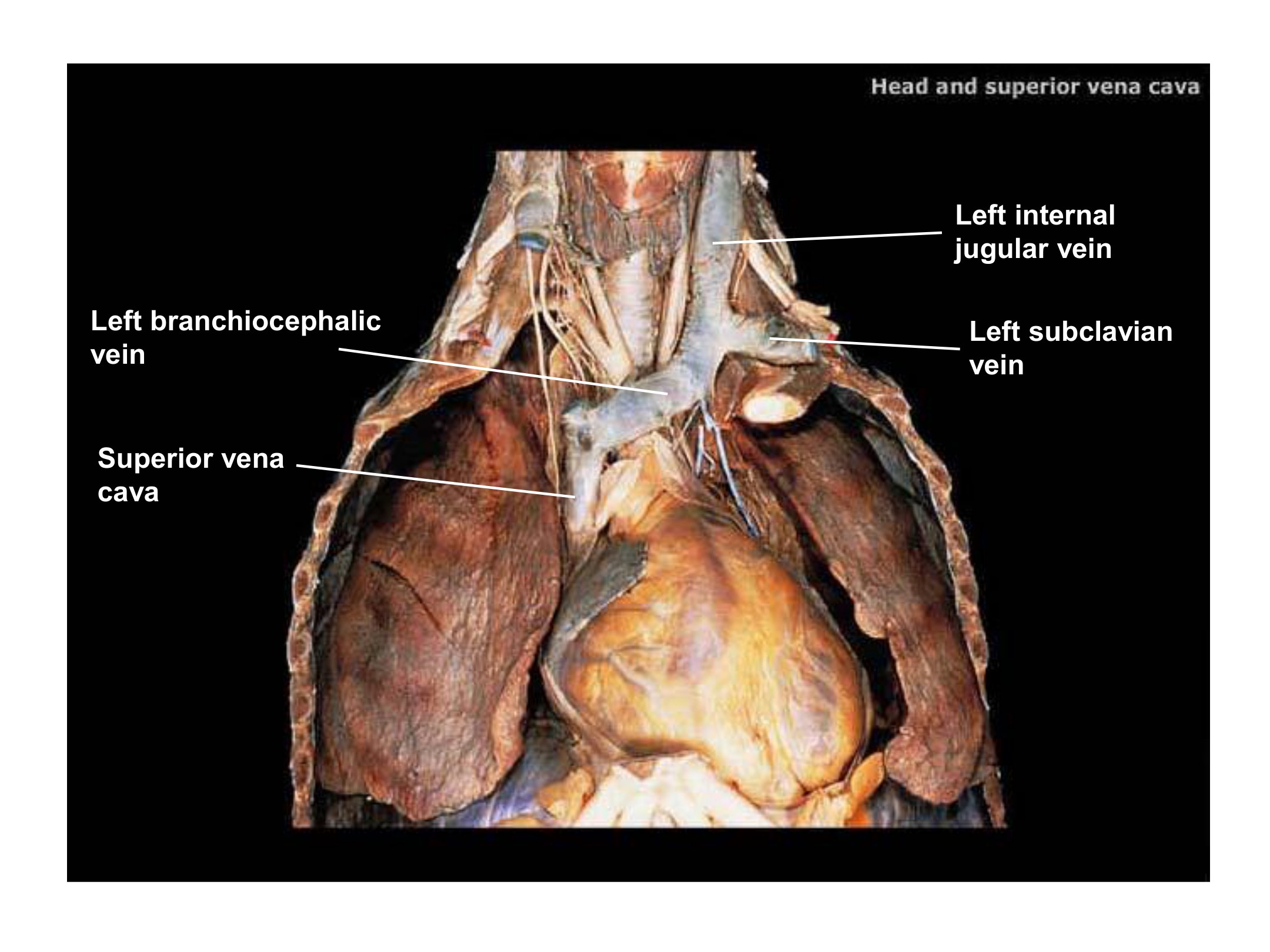 Head and Superior Vena Cava, fully labeled