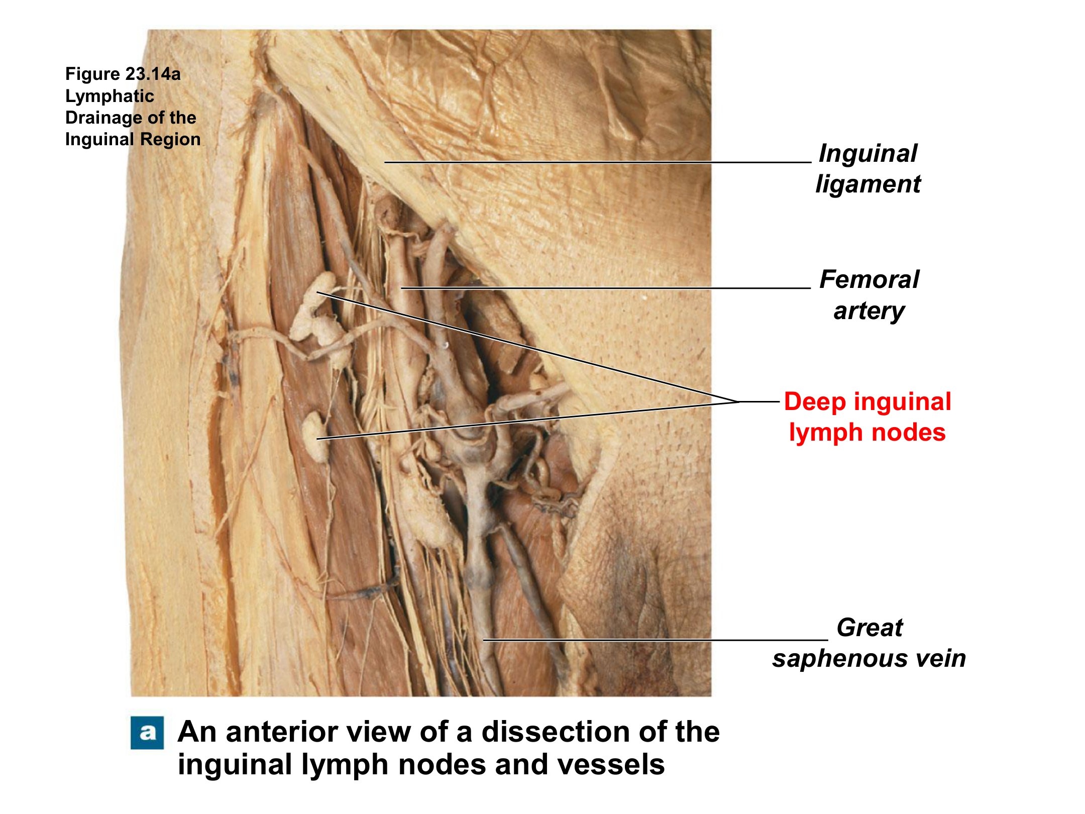 Lymphatic Drainage of the Inguinal Region, fully labeled