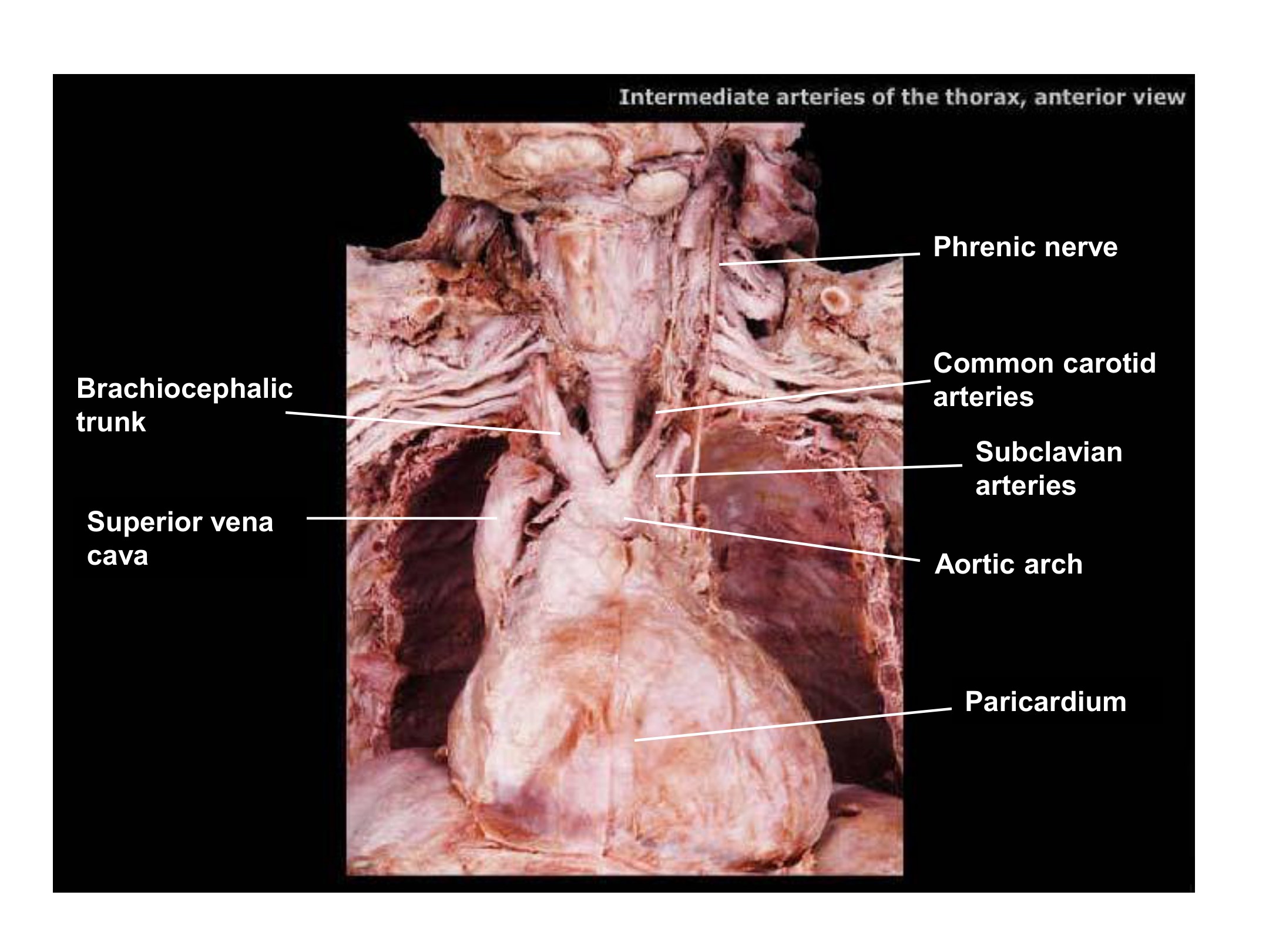 Intermediate Arteries of the Thorax, fully labeled