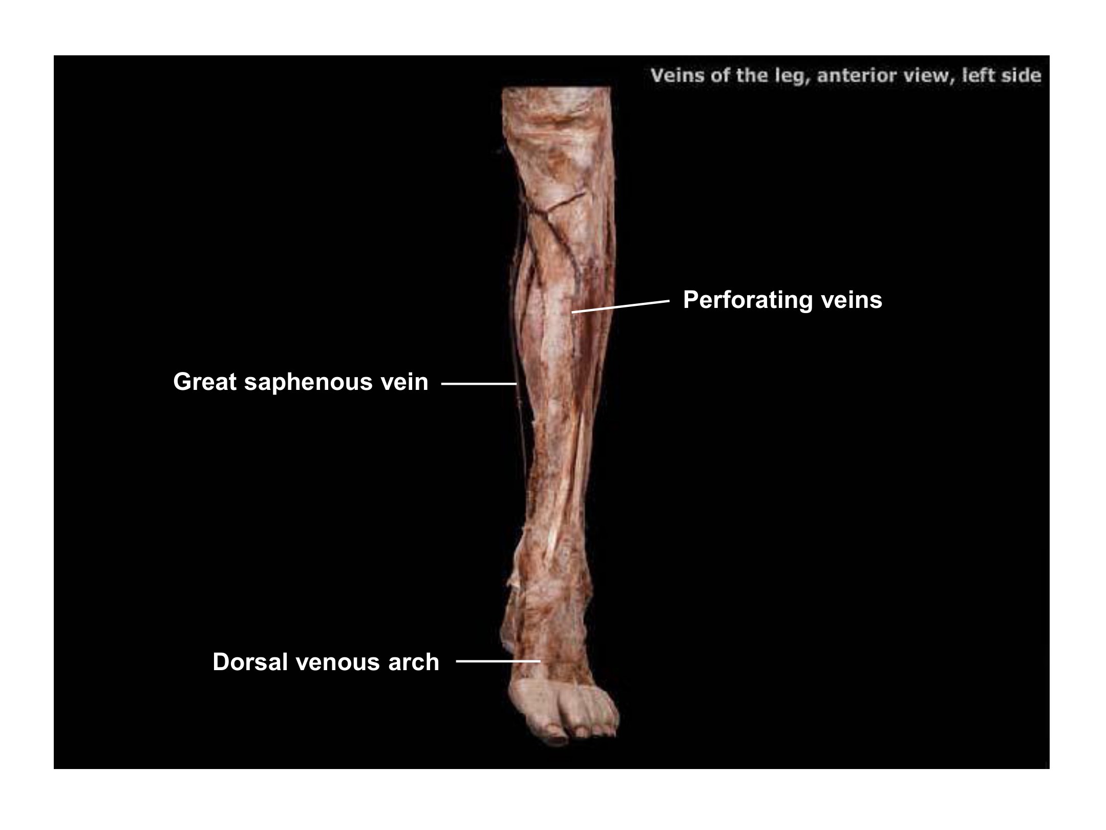 Veins of the Leg (Anterior View, Left Side), fully labeled