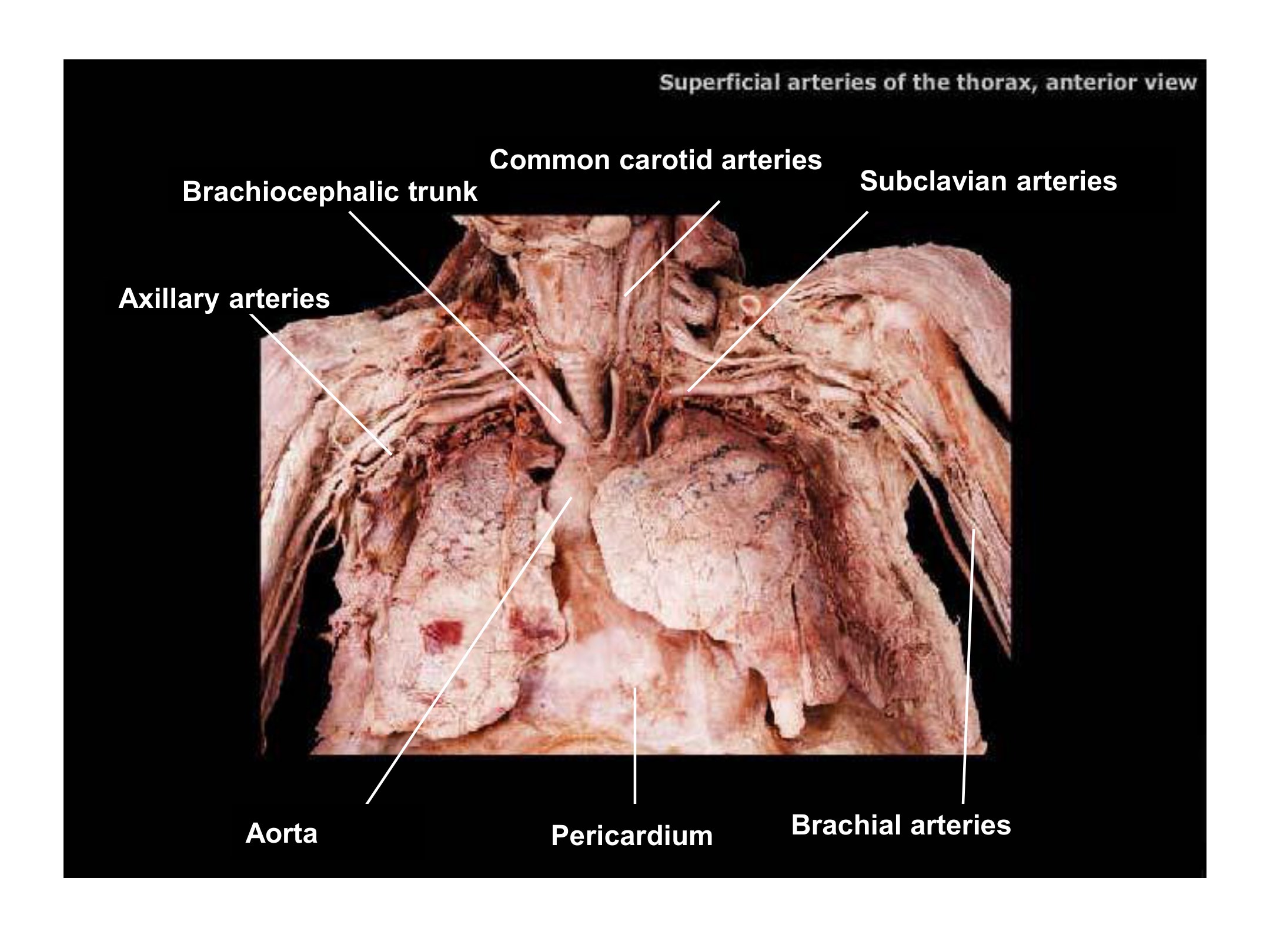 Superficial Arteries of the Thorax, fully labeled