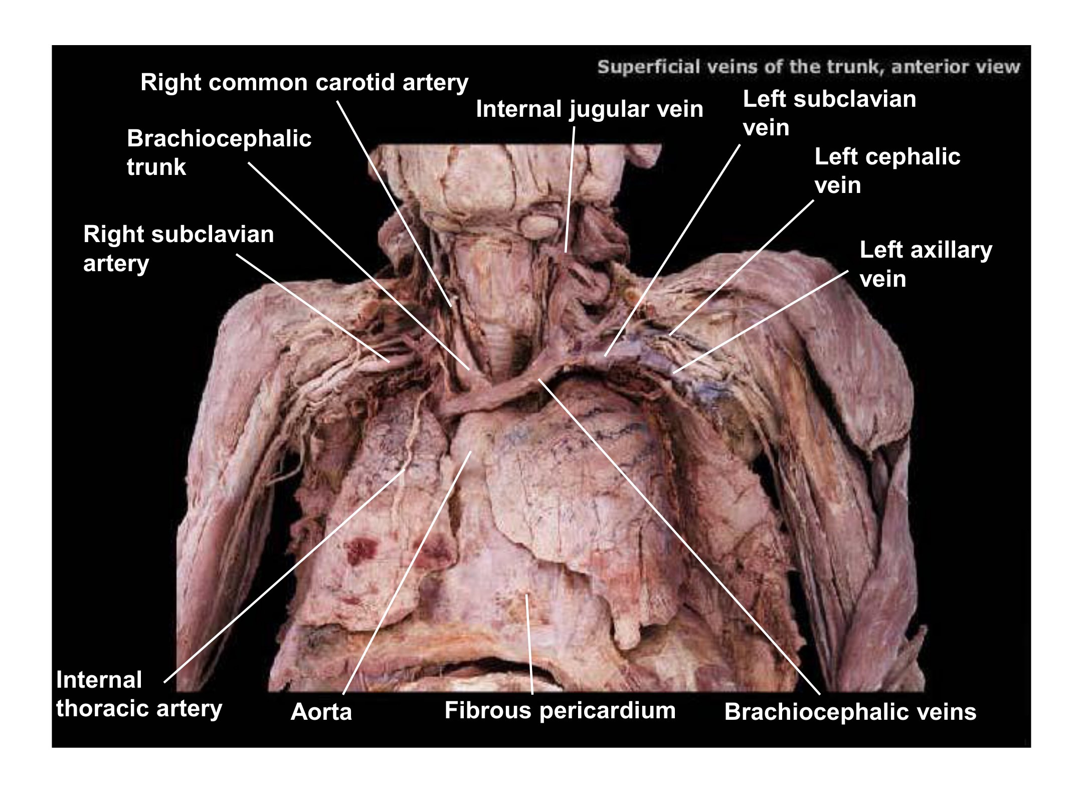Superficial Veins of the Trunk (Anterior View), fully labeled