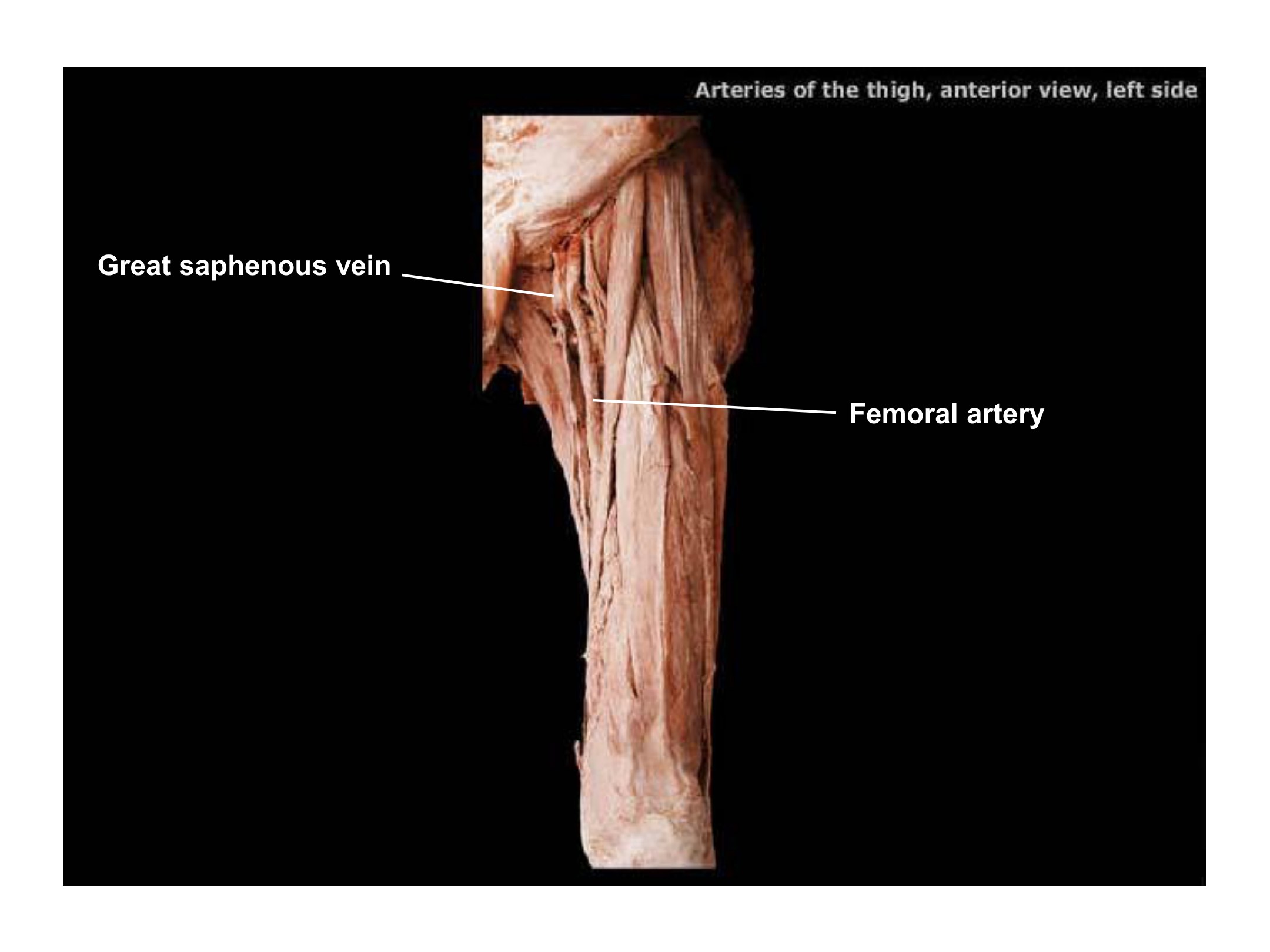 Arteries of the Thigh (Anterior View, Left Side), fully labeled