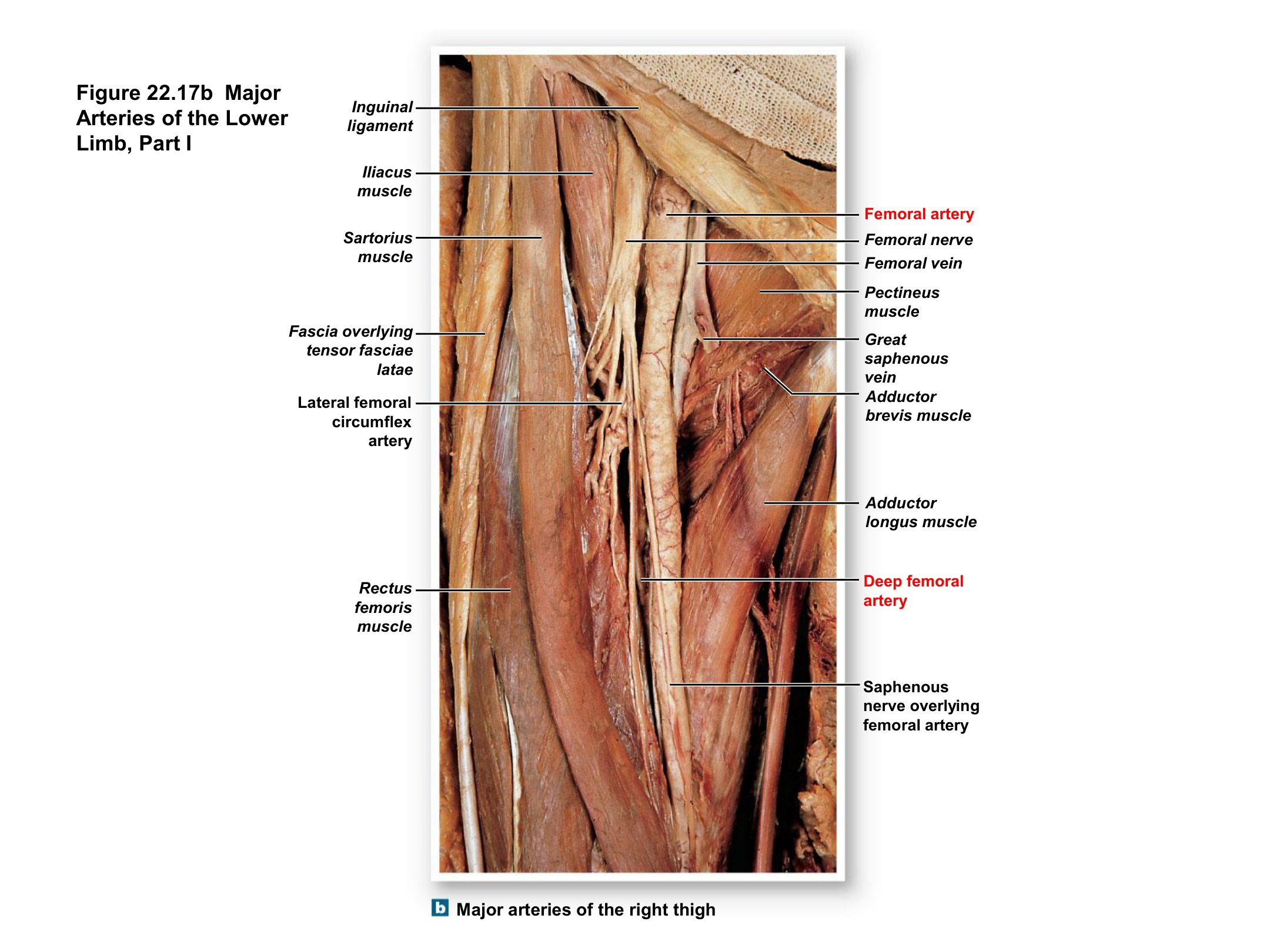 Major Arteries of the Right Thigh (Femoral Triangle Detail), fully labeled