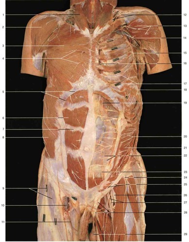 Anterior body 2, fully labeled