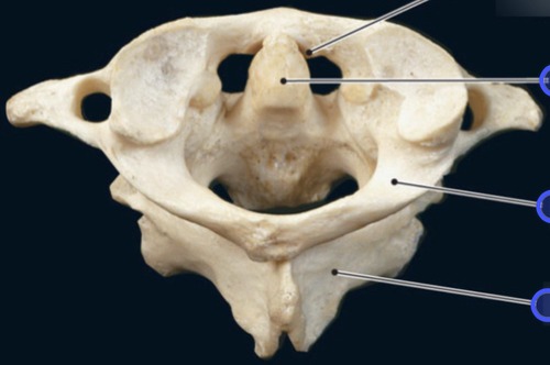 Atlanto-axial Joint, fully labeled