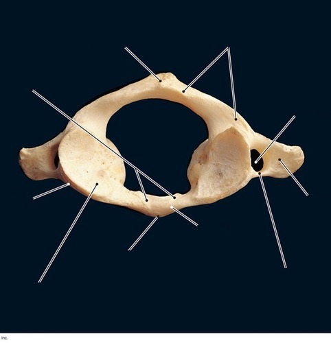 Atlas (C1) — Anterior arch, fully labeled