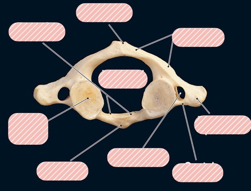 Atlas (C1) — Posterior tubercle, fully labeled