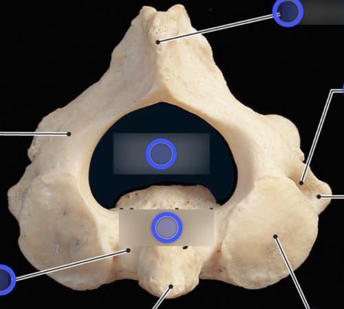 Axis (C2), fully labeled