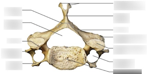 Cervical Vertebra — Bifid tip of spinous process, fully labeled