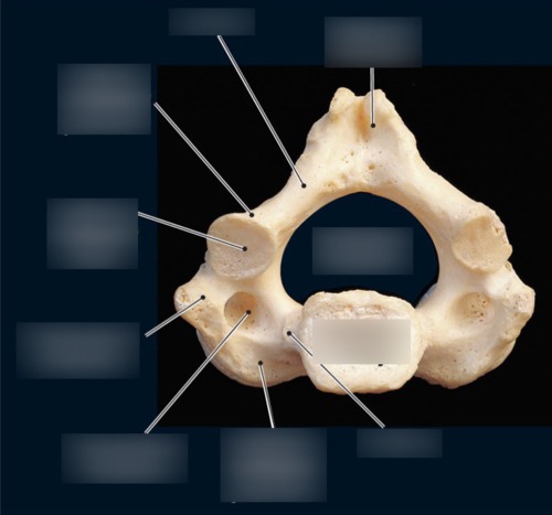Cervical Vertebra — Inferior articular process, fully labeled