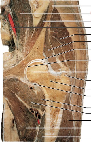 Coronal through hip, fully labeled