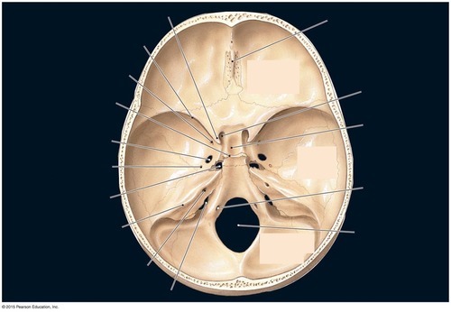 Cranial Floor (internal base) — Petrous part of temporal bone, fully labeled