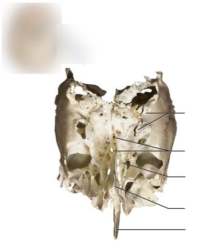 Ethmoid Bone, fully labeled