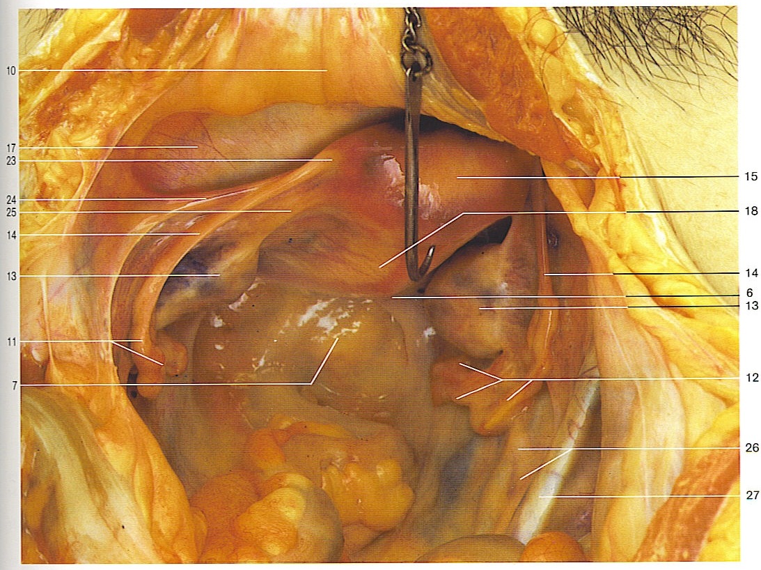 Female Reproductive — Right common iliac artery (Lab 7, Slide 3), fully labeled