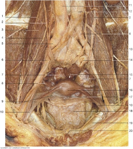 Female Reproductive — Superior hypogastric plexus (Lab 7, Slide 4), fully labeled