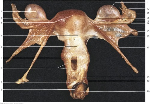 Female Reproductive — Suspensory ligament of ovary (Lab 7, Slide 8), fully labeled