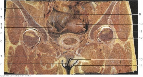 Female Reproductive — Uterus and vesico-uterine pouch (Lab 7, Slide 2), fully labeled