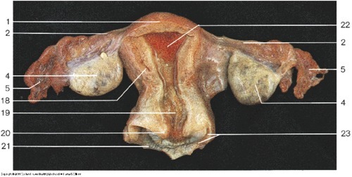 Female Reproductive — Vaginal portion of cervix of (Lab 7, Slide 9), fully labeled