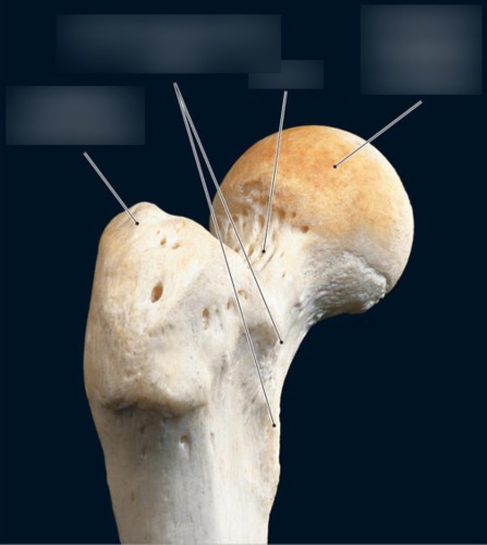 Femur — Articular surface of head, fully labeled