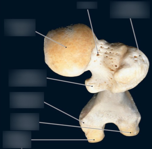 Femur — Femoral head, fully labeled