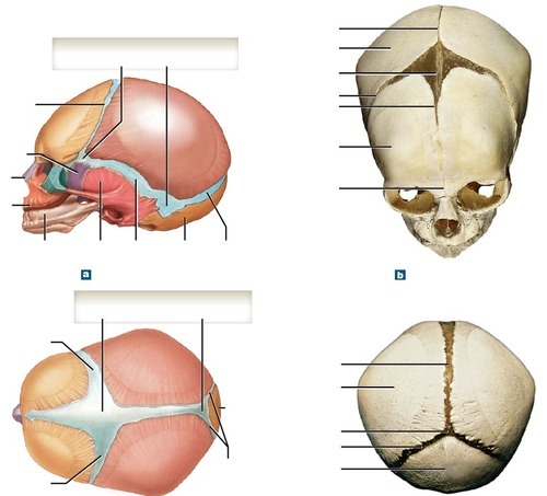 Fetal Skull (fontanelles), fully labeled