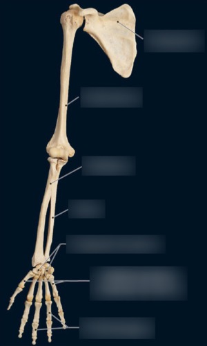 Hand & Wrist — Metacarpal bones (I to V), fully labeled