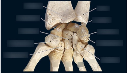 Hand & Wrist — Metacarpal III, fully labeled