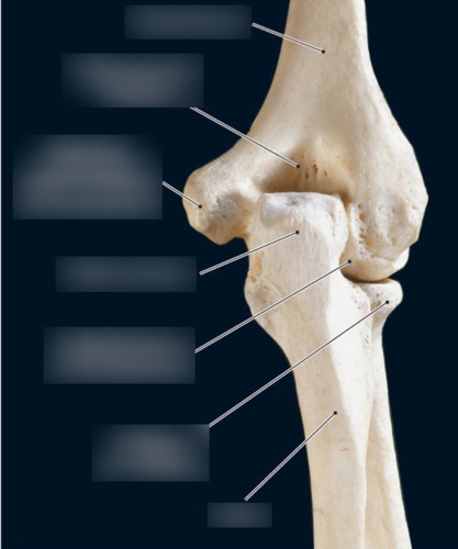Humerus — Medial epicondyle of humerus, fully labeled