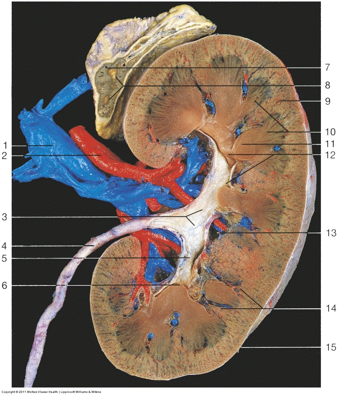 Kidney & Urinary Tract — Cribriform area of renal papilla (Lab 2, Slide 9), fully labeled