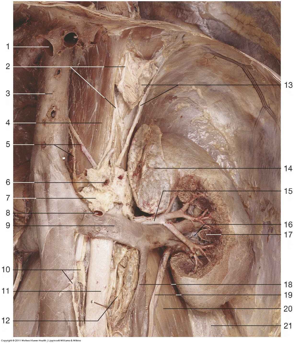 Kidney & Urinary Tract — Esophagus (cut) and left greater (Lab 2, Slide 2), fully labeled