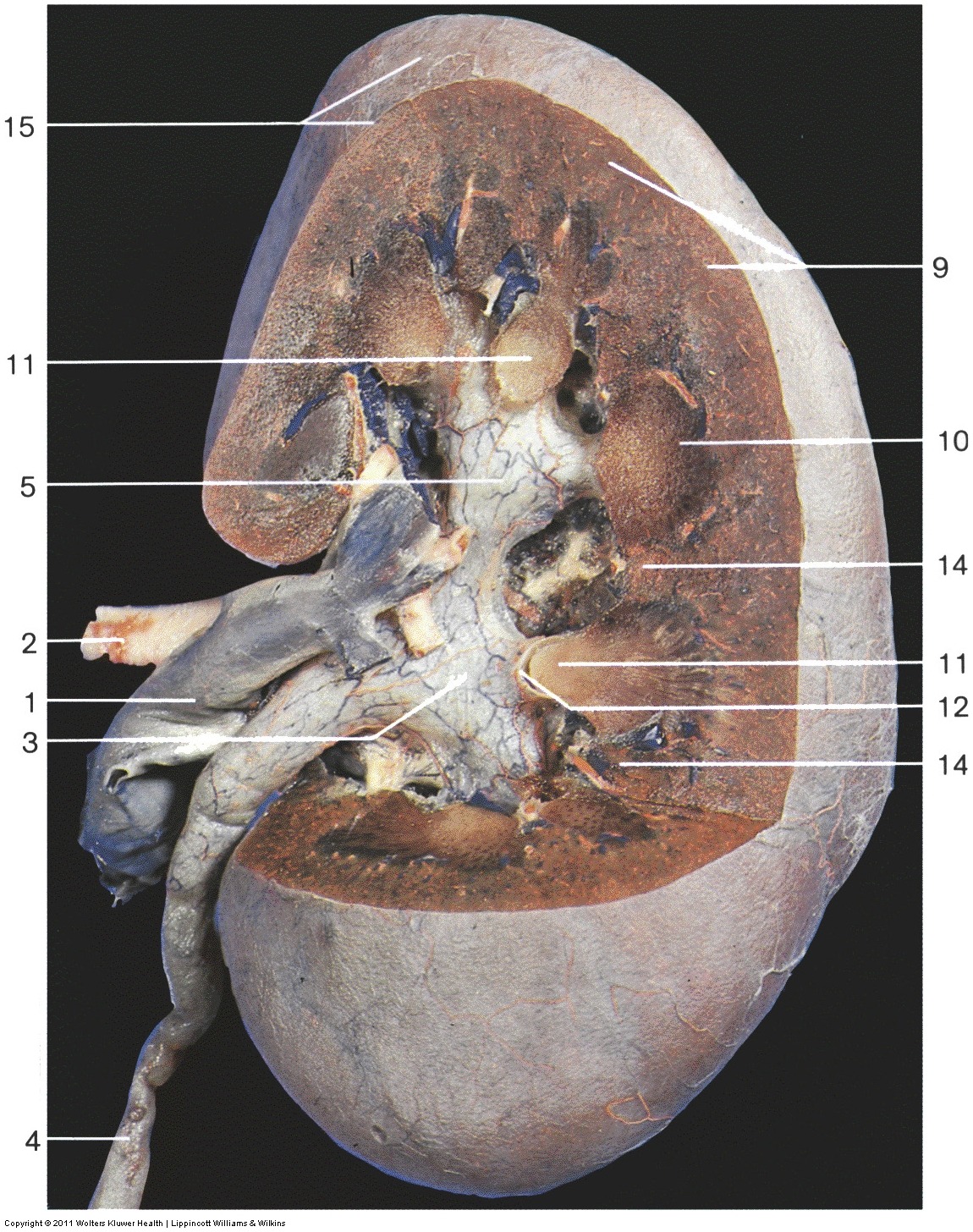 Kidney & Urinary Tract — Fibrous capsule of kidney (Lab 2, Slide 10), fully labeled