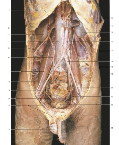 Kidney & Urinary Tract — Iliohypogastric nerve and (Lab 1, Slide 28), fully labeled