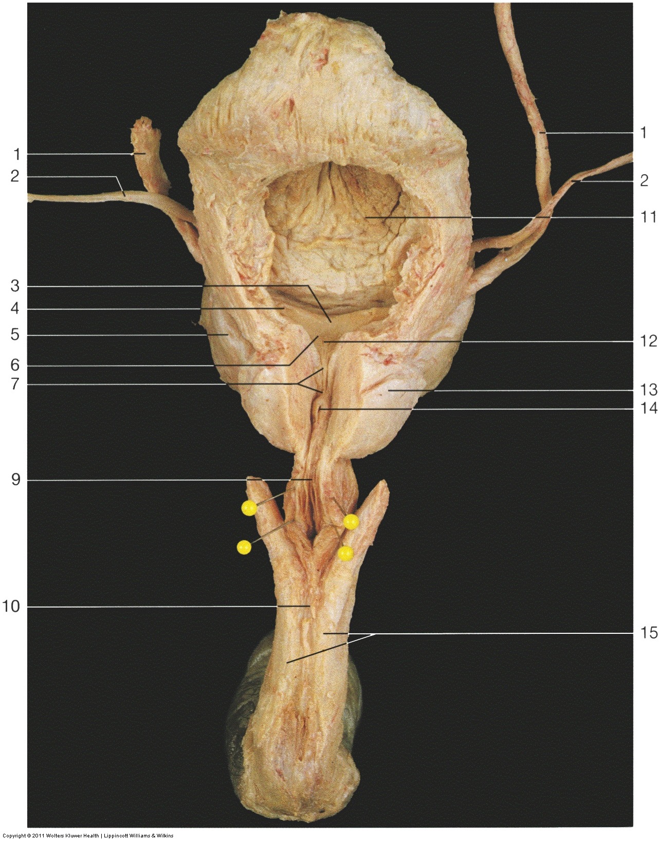 Kidney & Urinary Tract — Prostatic urethra with seminal (Lab 2, Slide 5), fully labeled