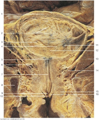 Kidney & Urinary Tract — Pubic bone (cut edge), Bulb of (Lab 7, Slide 7), fully labeled