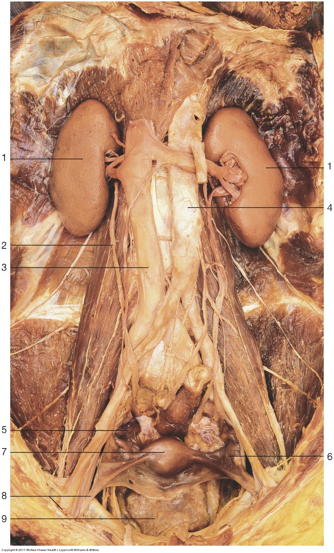 Kidney & Urinary Tract — Round ligament of uterus and (Lab 2, Slide 1), fully labeled