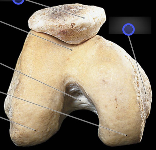 Knee, fully labeled