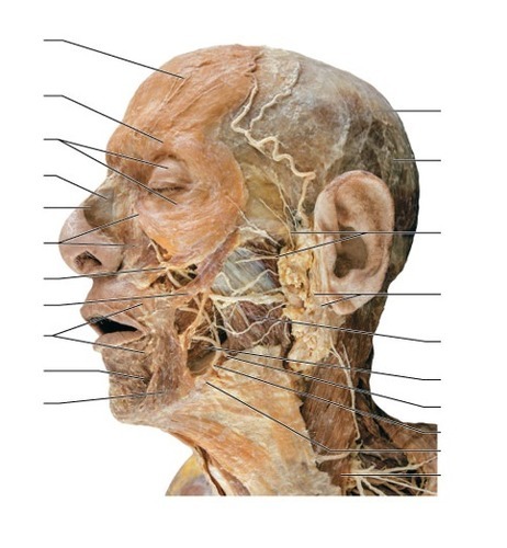 Lateral, fully labeled