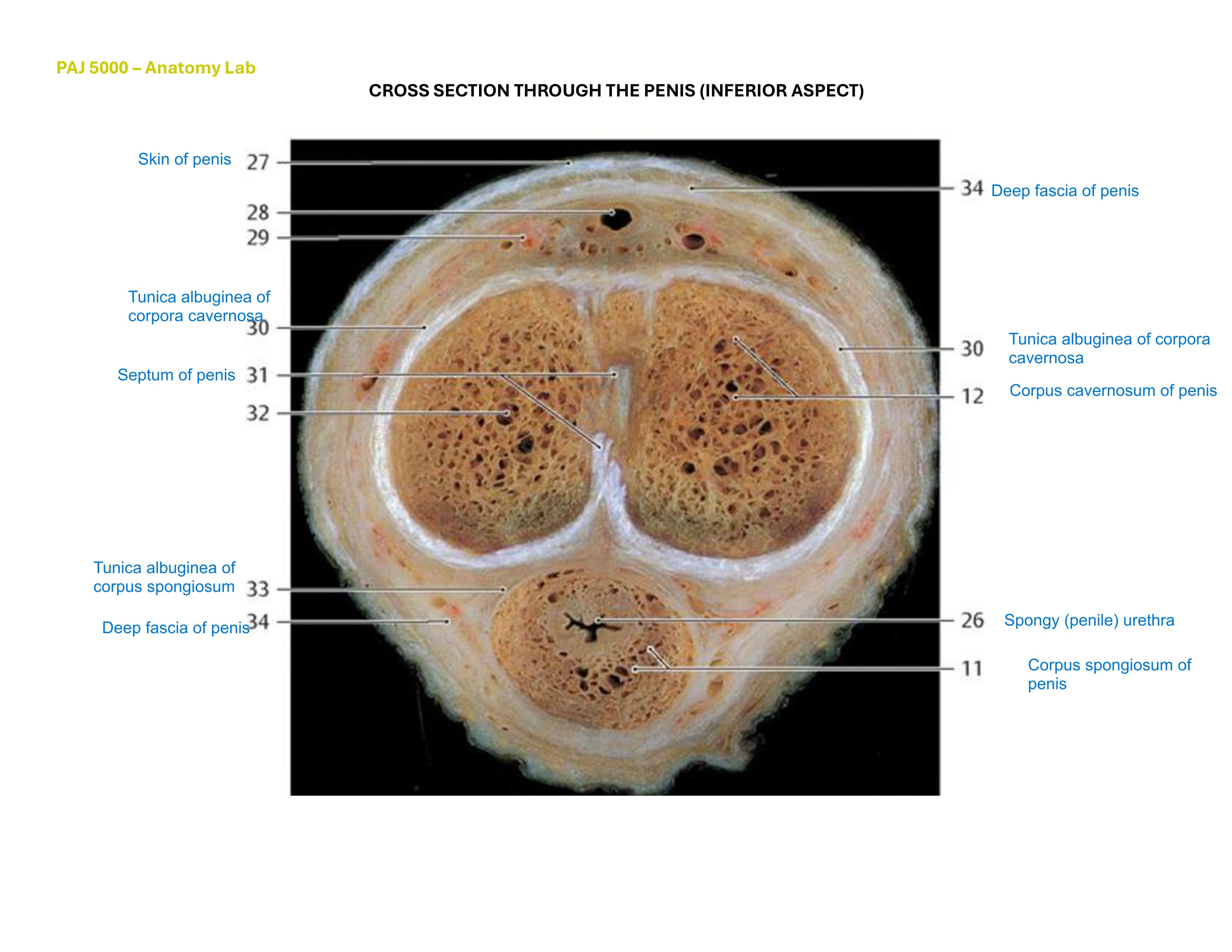 Cross Section Through the Penis (Inferior Aspect), fully labeled