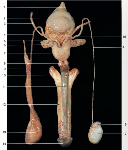 Male Reproductive — Apex of urinary bladder with (Lab 8, Slide 6), fully labeled